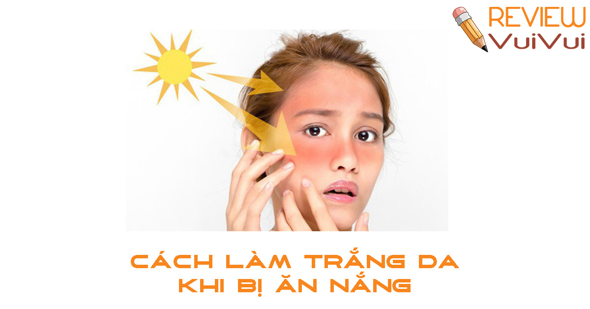 cách làm trắng da khi bị ăn nắng